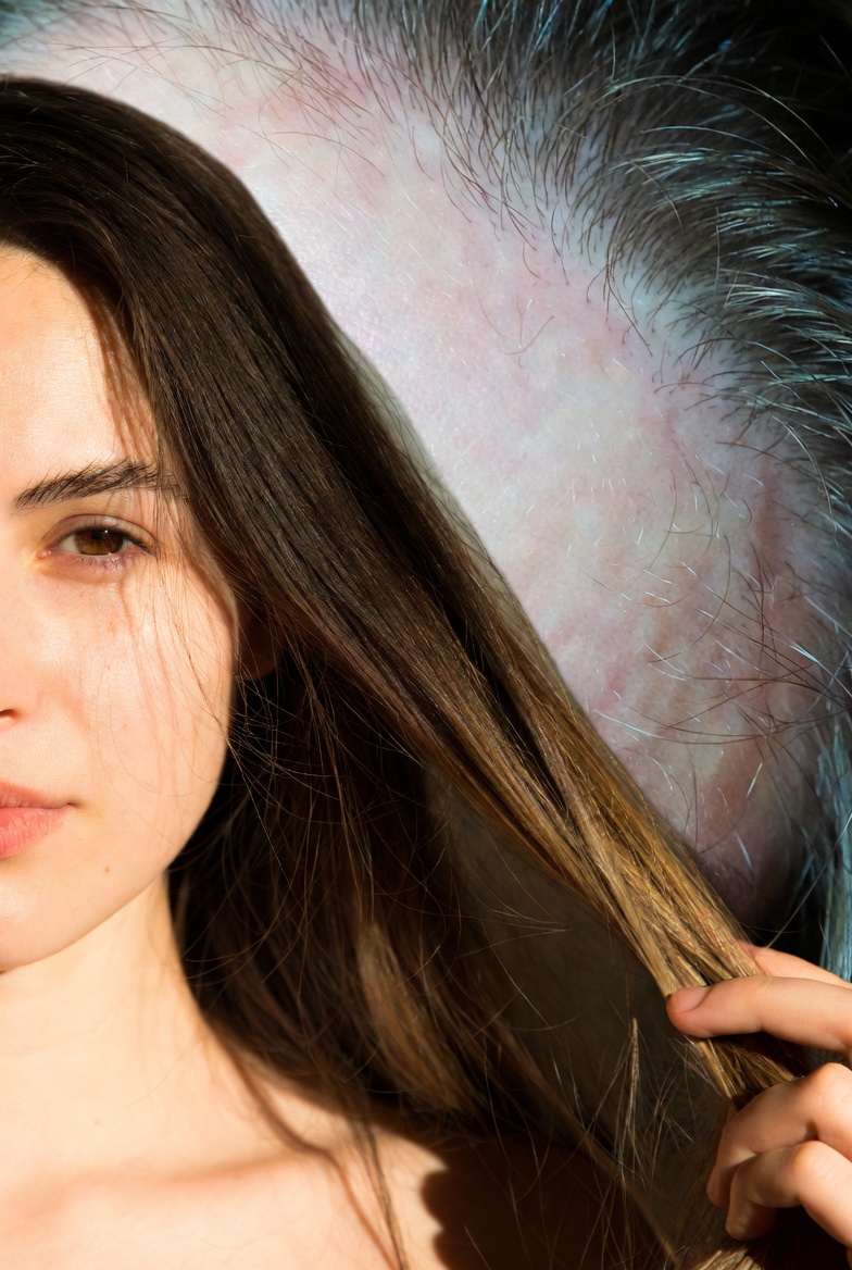 A range of new FDA-approved hair loss treatments available in 2025.