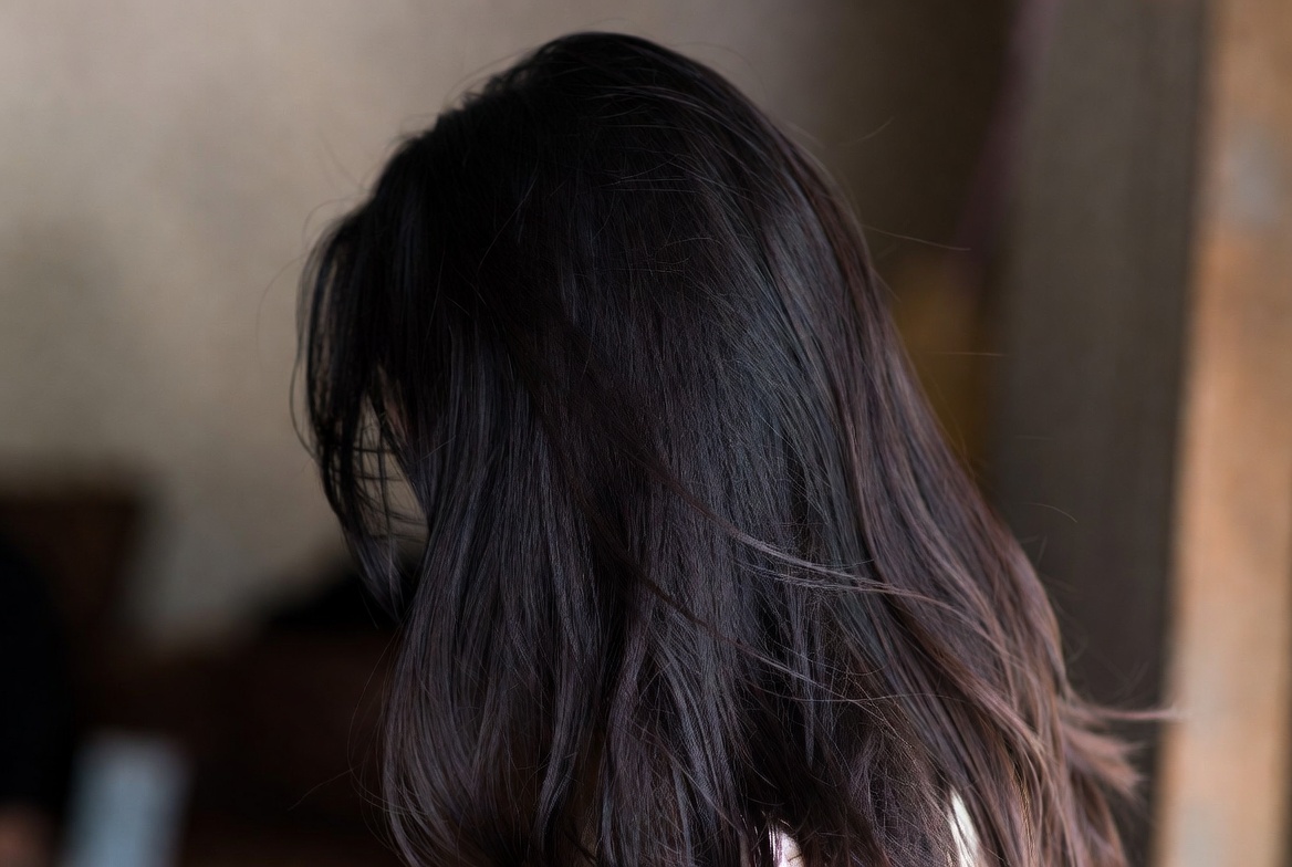 Man examining hair loss in mirror, representing male pattern baldness concerns